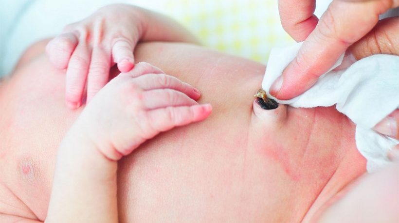 Umbilical Hernia In Newborns